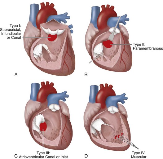 Congenital Cardiac Surgery Clinical Gate