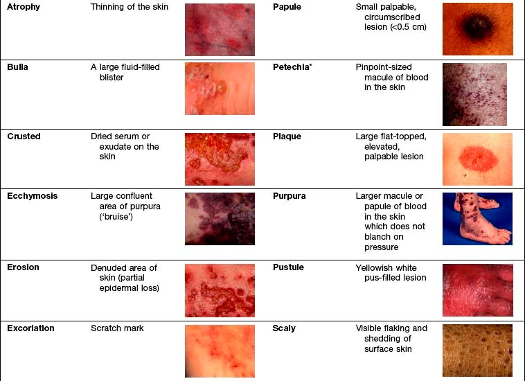 describing rashes