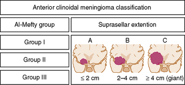 What are some types of meningiomas?