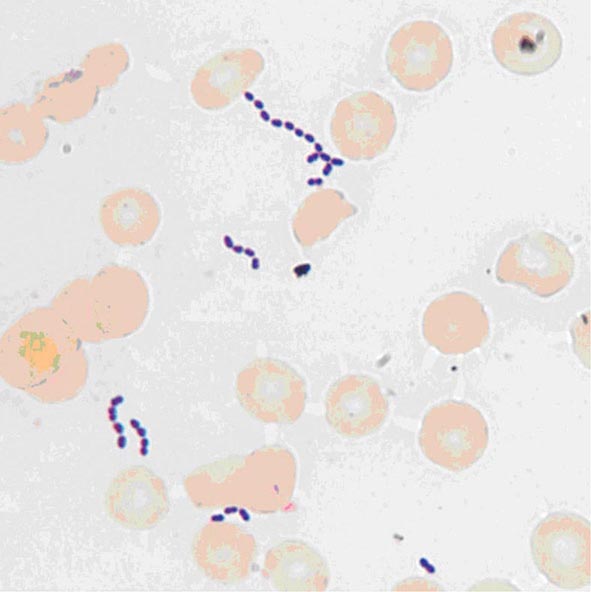 What causes enterococcus?