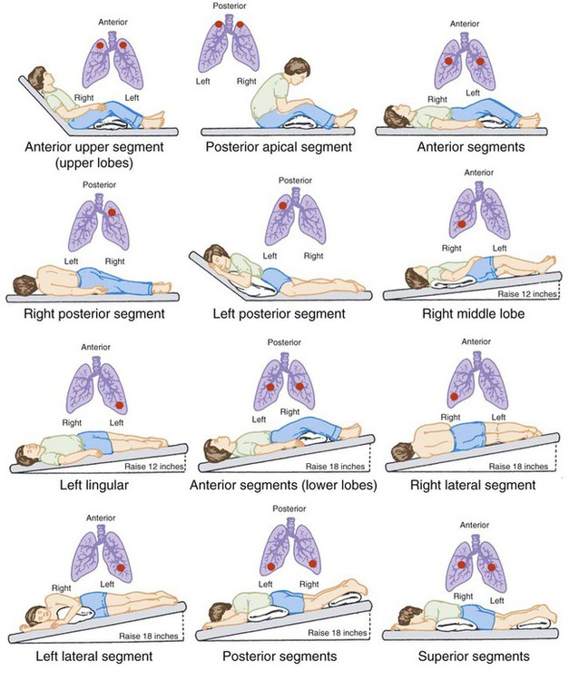 postural drainage