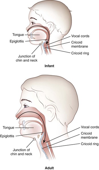 Enlarged Tonsils In Adults 33