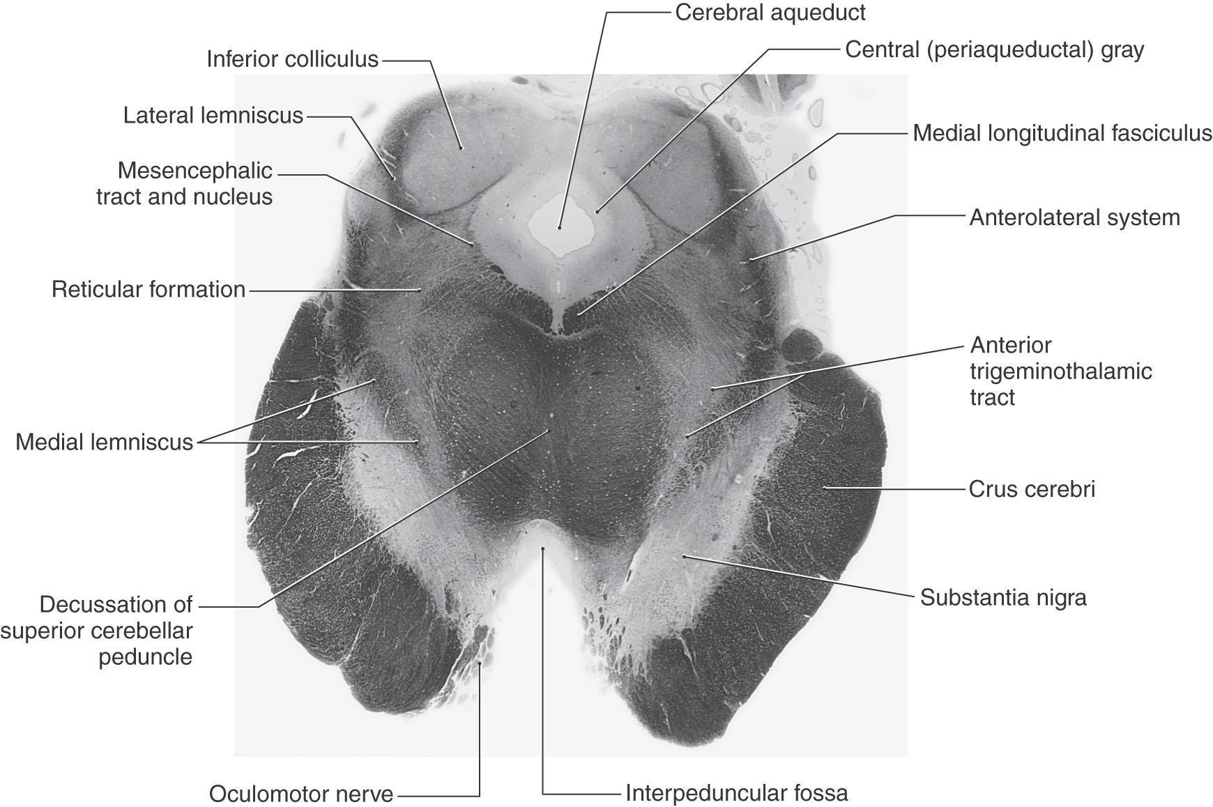 Medulla of the brain
