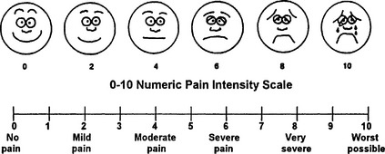 77: Acute Pain Management | Clinical Gate