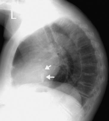 Chest Radiography Clinical Gate
