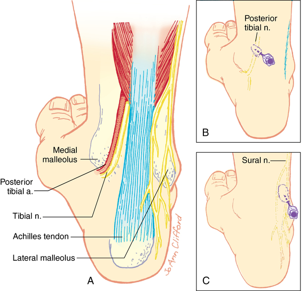 N suralis. Suralis нерв анатомия. Posterior tibial nerve. A suralis анатомия. Иннервация пальцев ног Суралис.