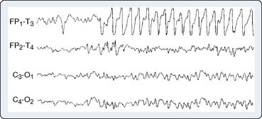 Central Nervous System Monitoring | Clinical Gate