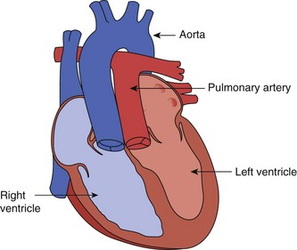 Essentials of Cardiology | Clinical Gate