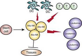 HSCT From Alternative Sources And Donors | Clinical Gate