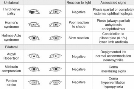 Pupil Dilation Chart