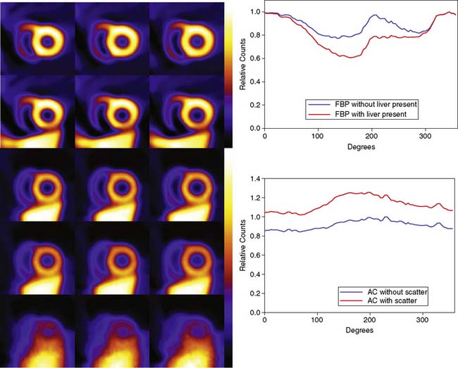 Attenuation/Scatter/Resolution Correction Physics Aspects Clinical Gate