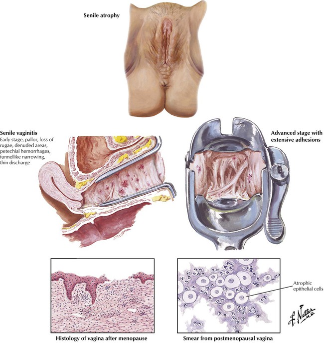 Impact Of Glycyrrhiza Glabra