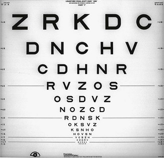 20/20 Vision and Understanding Your Visual Acuity Score - North Florida  Cataract and Vision