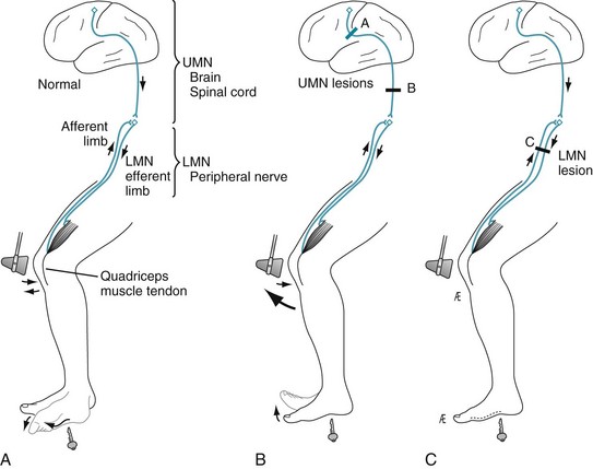 Upper Limb Deep Tendon Reflexes