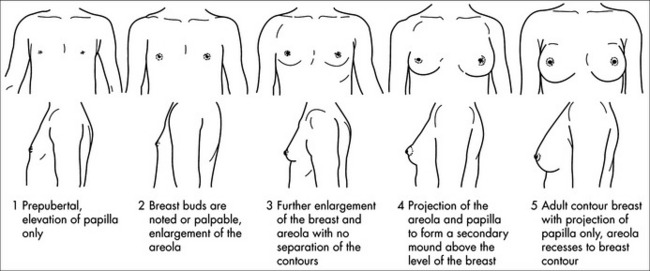 This line drawing of the Tanner Stages maturation of women's