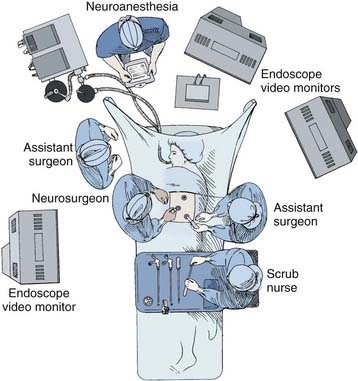 Thoracoscopic Approaches To The Spine Clinical Gate