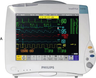 57: Electrocardiographic Leads and Cardiac Monitoring | Clinical Gate