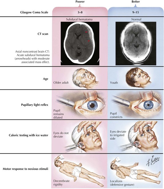 Bid to stop brain test on coma relative