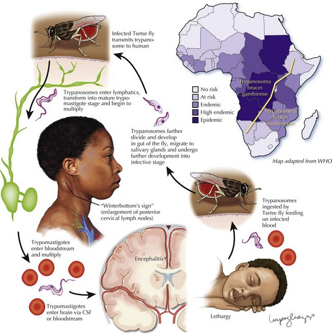 Parasitic And Fungal Disorders And Neurosarcoidosis Clinical Gate 3970