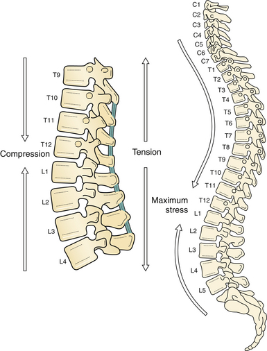 Thoracolumbar Spine Fractures Clinical Gate