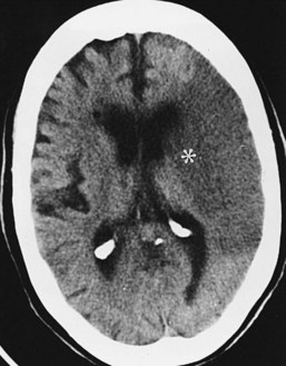 Neuroimaging | Clinical Gate