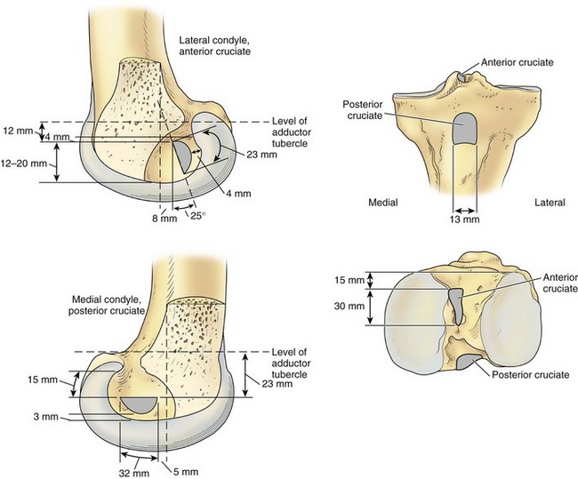 sulcus terminalis lateral femoral condyle