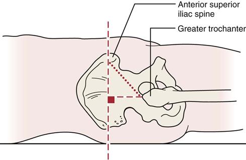 Hip Clinical GateClinical Gate Hip Clinical GateClinical Gate