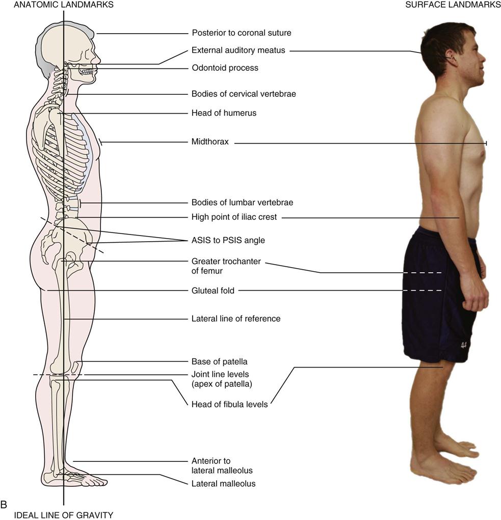 Assessment Of Posture Clinical Gate