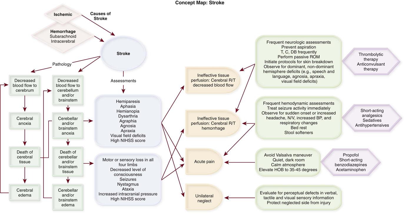 Concept Map Ischemic Stroke Docx Ischemia Stroke - vrogue.co