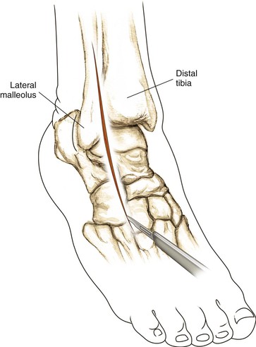 Foot And Ankle Clinical Gate
