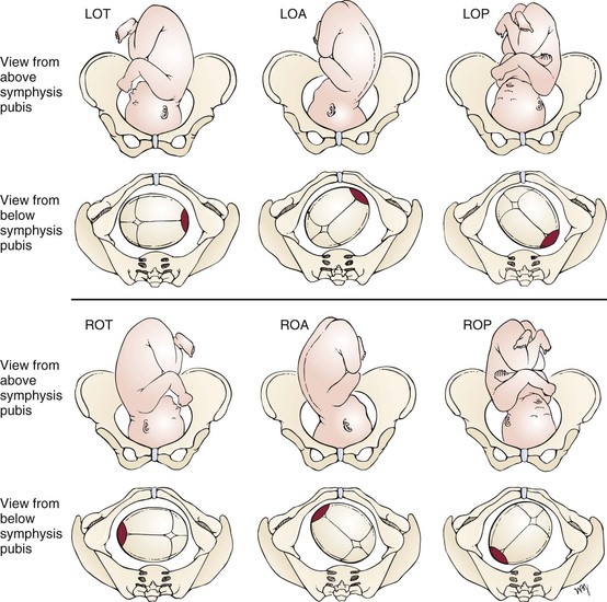 presentation vx pregnancy