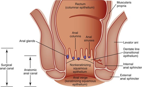 Lump Inside Anal Canal 89