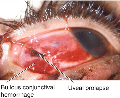 Conjunctiva And Sclera Clinical Gate