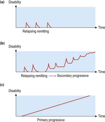 Multiple Sclerosis I | Clinical Gate