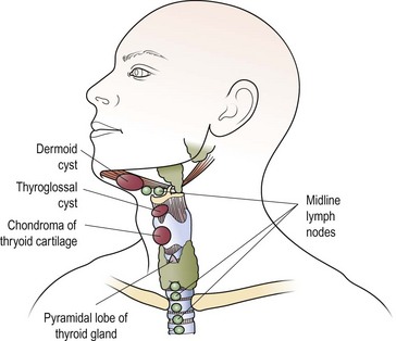 Head and Neck Neoplasia | Clinical Gate
