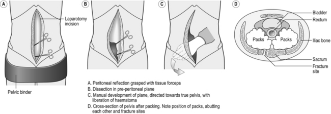 The Severely Injured Patient | Clinical Gate