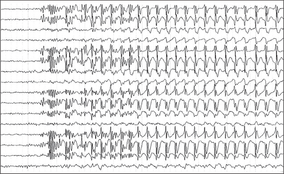 Neurology | Clinical Gate