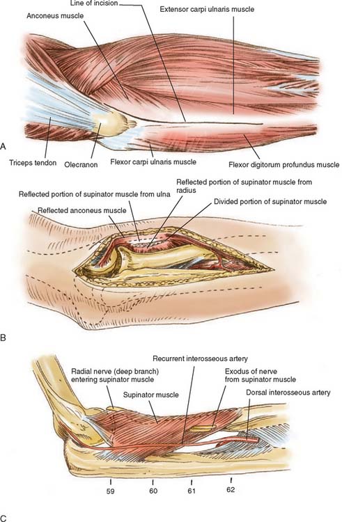 Surgical Exposures Of The Elbow Clinical Gate