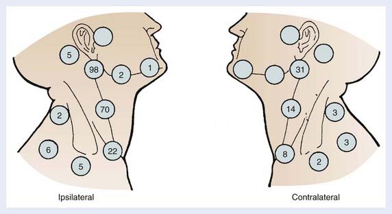 Cancer Of The Larynx Clinical Gate