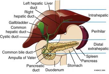 Cancer of the Liver, Bile Duct, and Gallbladder | Clinical Gate