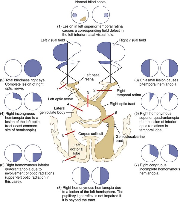 Visual Loss Clinical Gate Visual Loss Clinical Gate