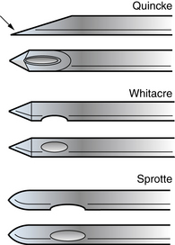 Spinal Fluid Examination | Clinical Gate