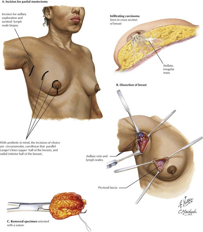 The Breast  Clinical Gate