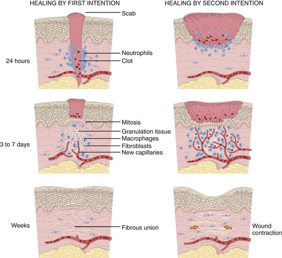 principles-of-wound-management-clinical-gate