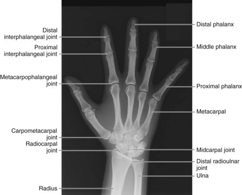 1: Examination of the Hand and Wrist | Clinical Gate