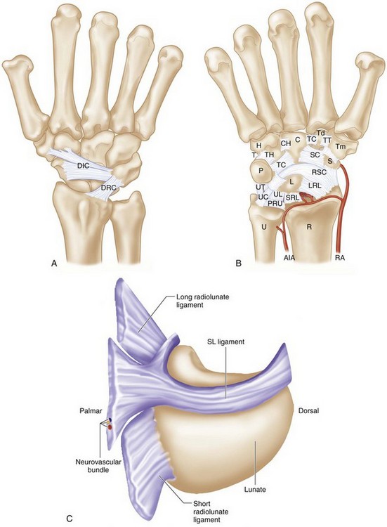 71: Open Reduction and Acute Repair of Perilunate Fracture-Dislocations ...