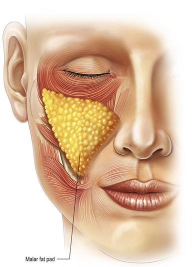 Facelift With Smas Technique And Fame Clinical Gate