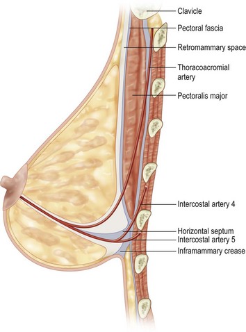 Mastopexy  Clinical Gate