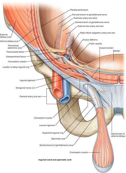 Figure 1 from Sports Hernia/Athletic Pubalgia