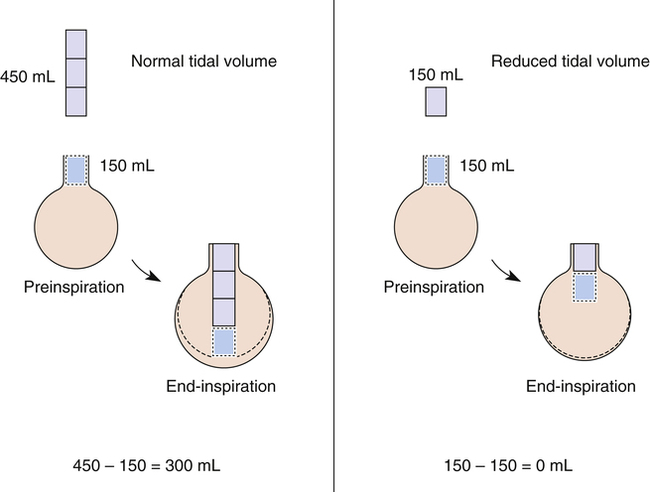 Is residual volume a synonym for dead space volume? If not, then